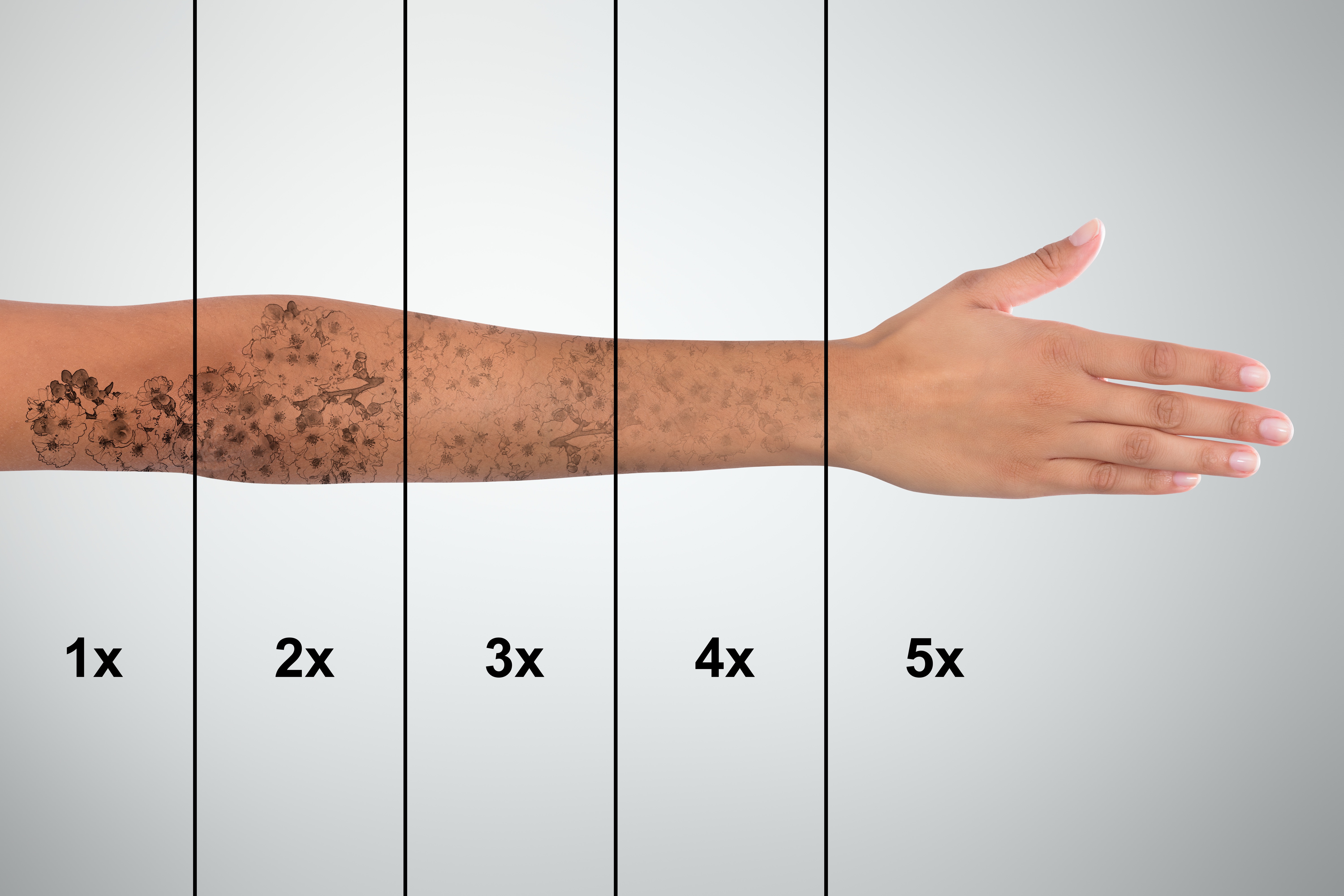 Laser tattoo removal fading results consultation South Oxfordshire